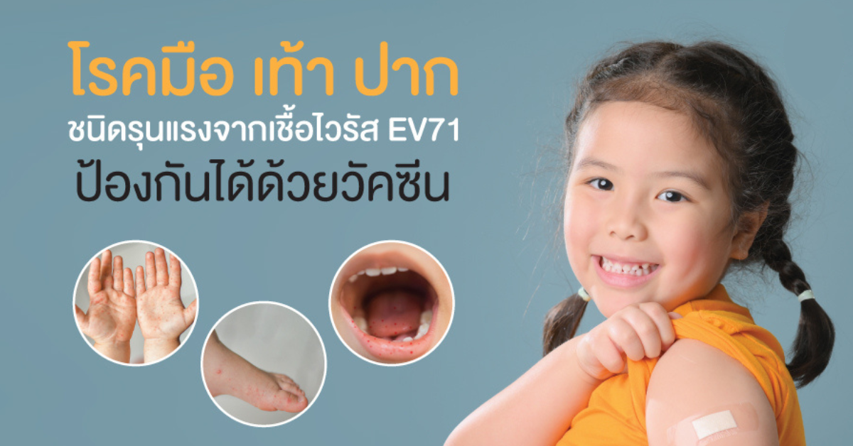 วัคซีนป้องกันโรคมือ เท้า ปาก