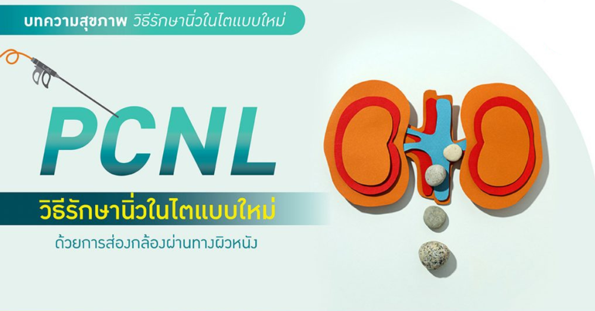 PCNLวิธีรักษานิ่วในไต